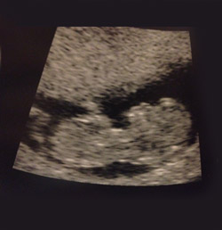 Baby Chloe